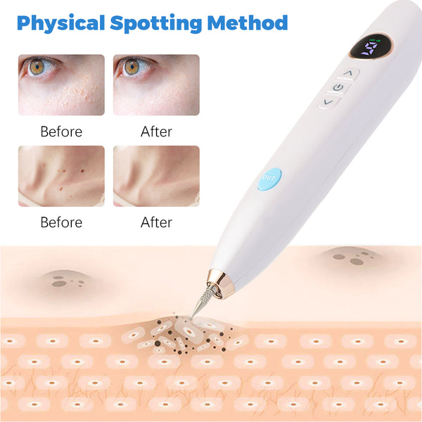 Laser Skin Tag Remover Face Mole Remove Plasma Pen Freckle Removal